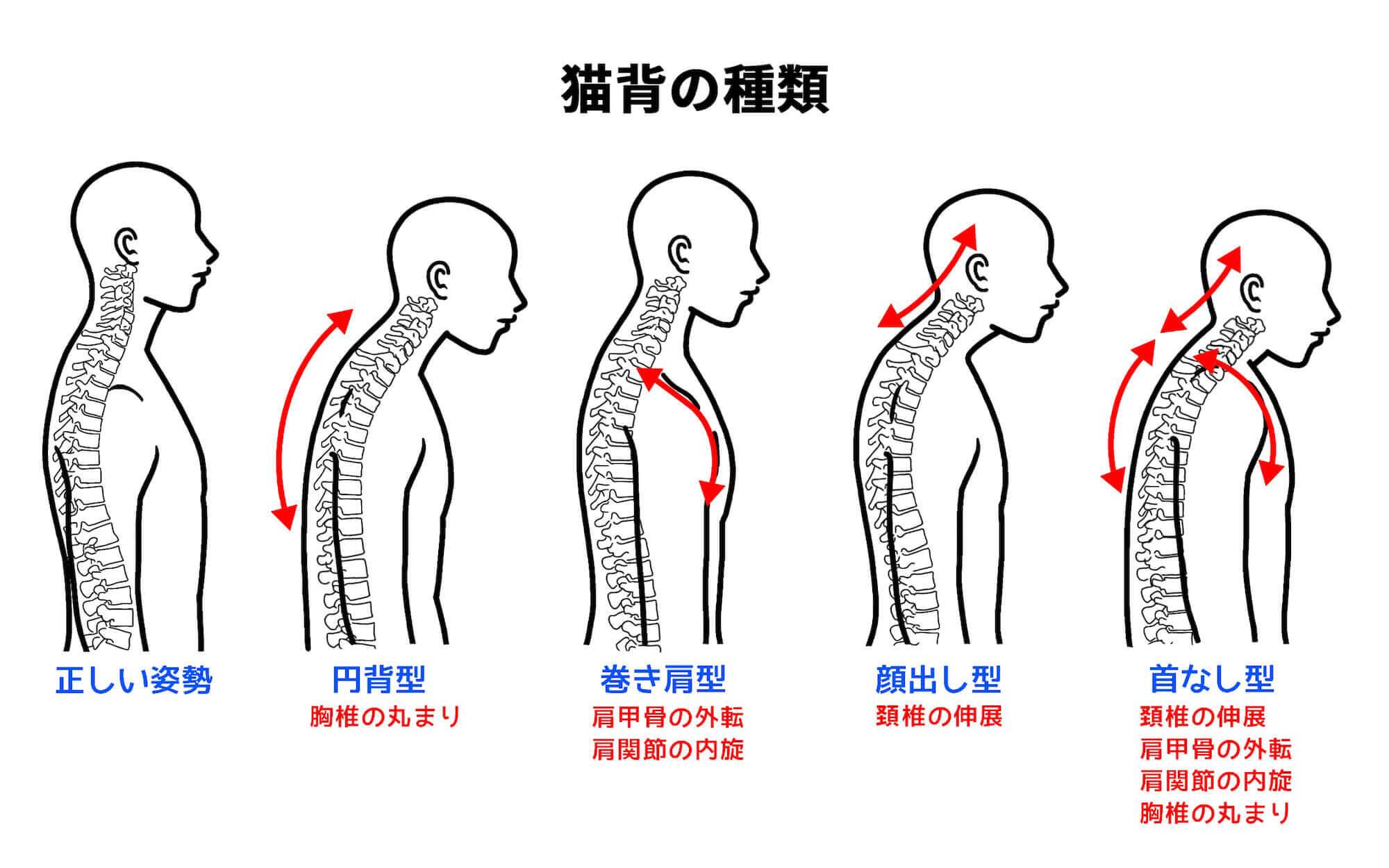 猫背を改善するための筋トレ【猫背の原因や鍛えるべき筋肉も解説します】 | Sharez for Trainer｜パーソナルトレーナー向けメディア